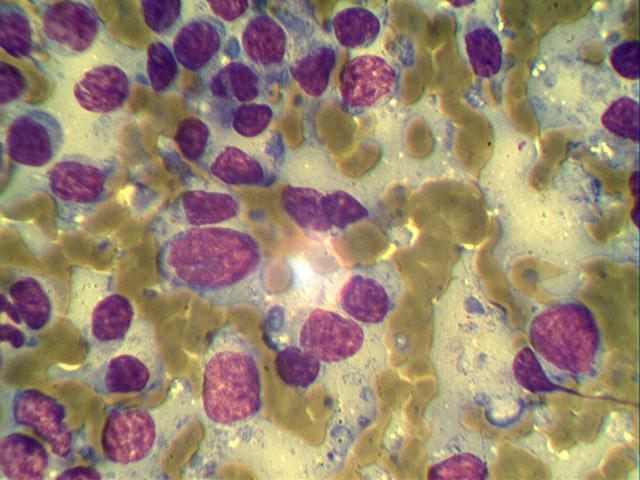 limfoma-kozhi Цитологическое исследование