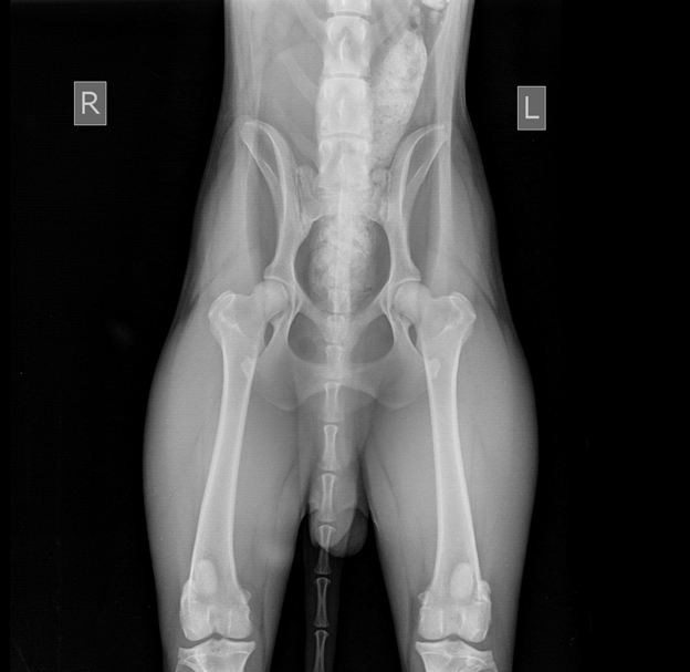 v-norme Диагностика дисплазии ТБС (HIP)