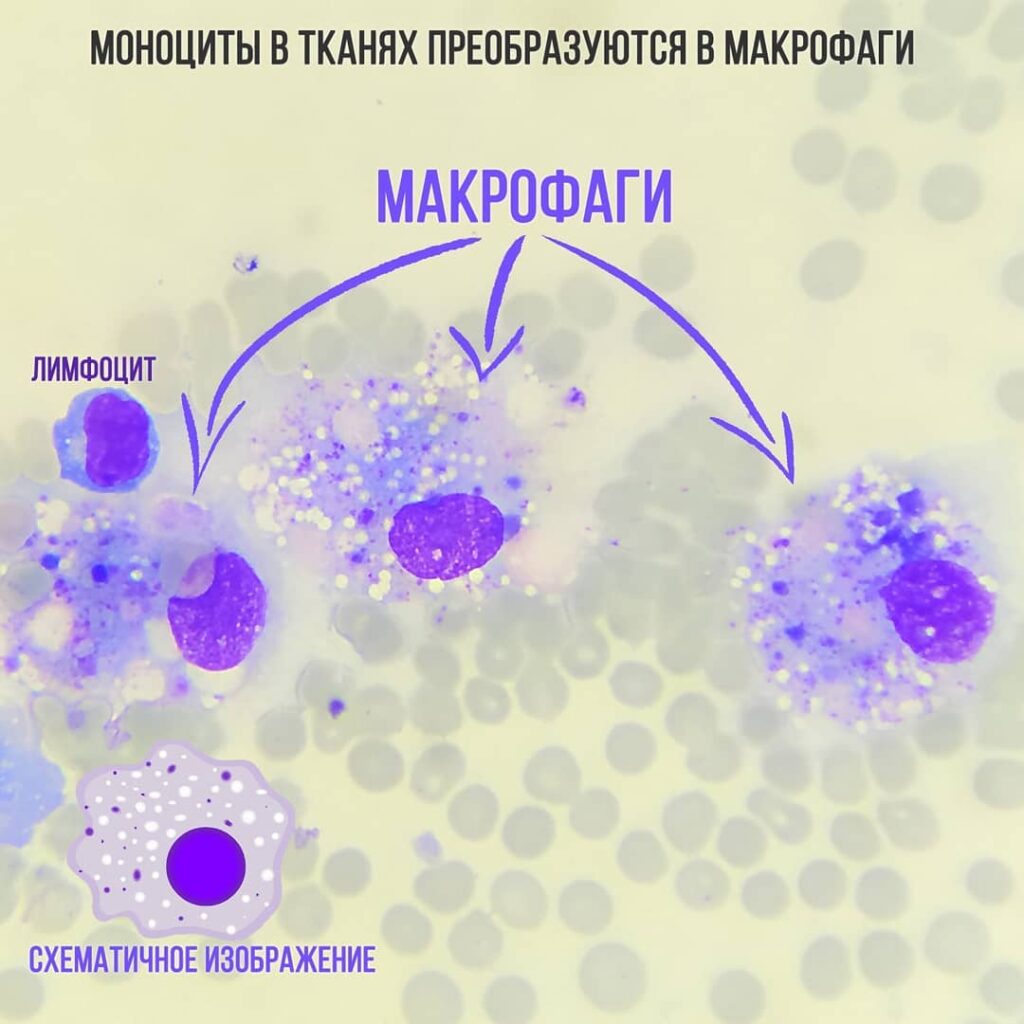 makrofagi-1024x1024 Общий анализ крови (ОАК). Лейкоциты (ч. 2)
