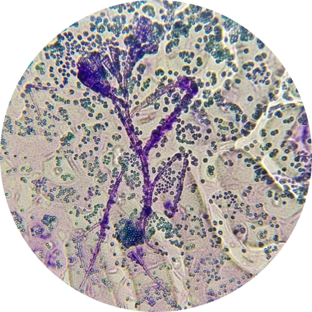 griby-roda-aspergillus Посев на грибы дерматофиты